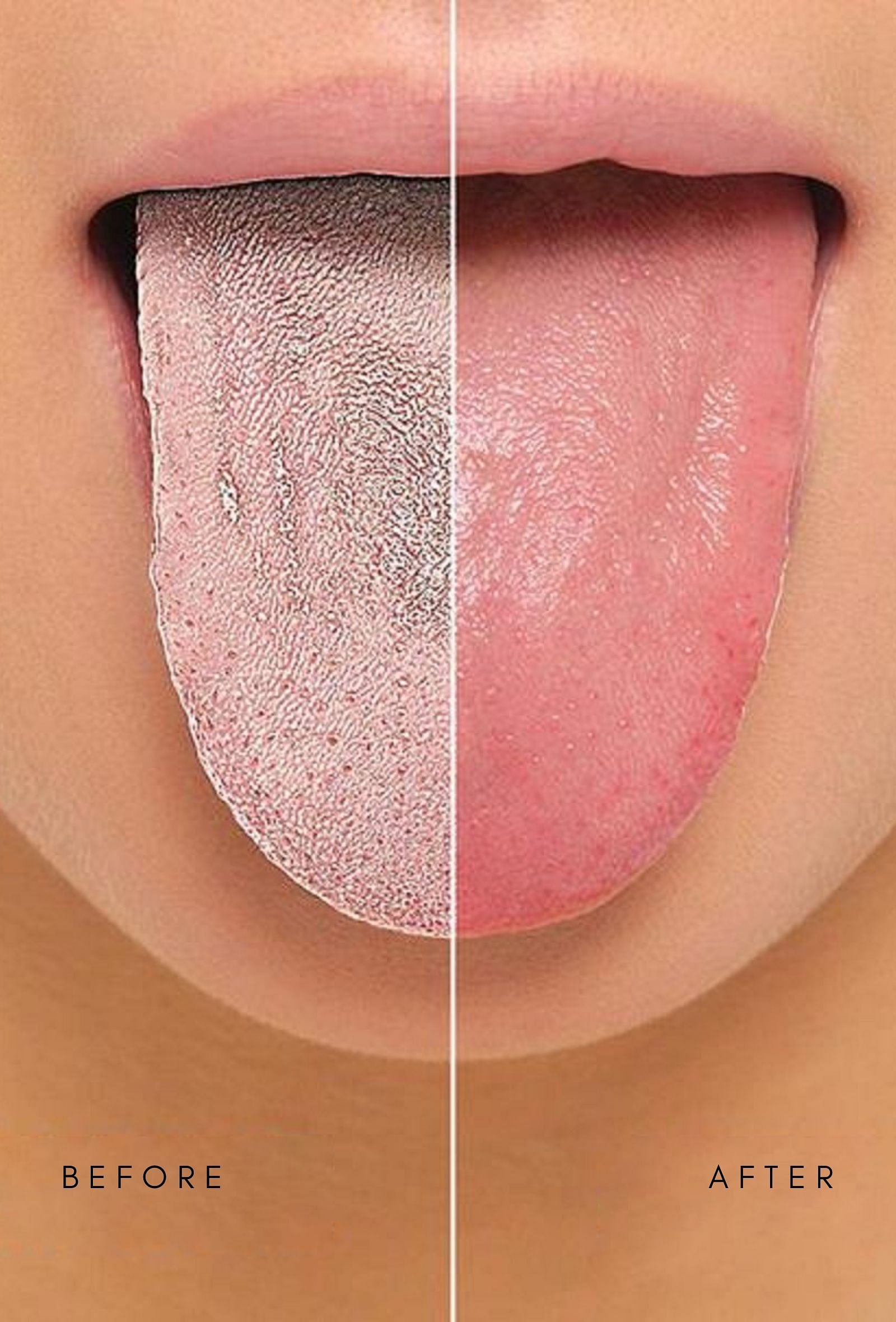 Set of 5: 100% Copper Tongue Scrapper