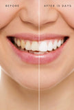 Teeth Brightening Powder: DASHANANSANSKAR CHURAN: Clove & Fenugreek